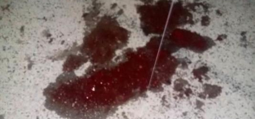 Bir ailə qəzaya düşdü: ana öldü, 3 nəfər xəstəxanada
