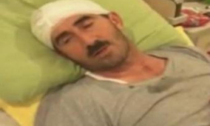 Mağazası yandı, özünü də maşın vurdu
