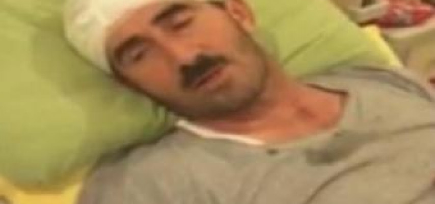 Mağazası yandı, özünü də maşın vurdu