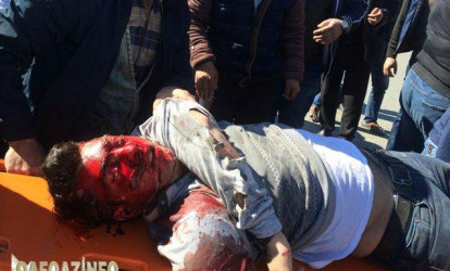 Bakıda "07" avtobusla toqquşdu; sürücü qana bulandı – FOTO (15+)