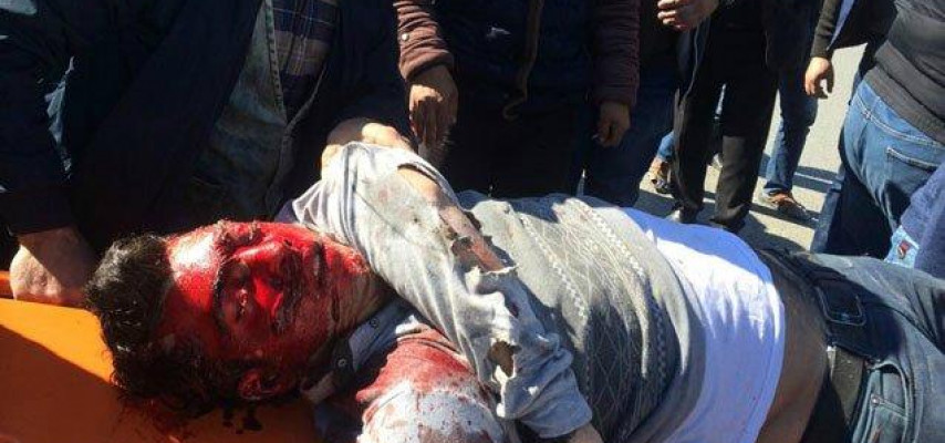 Bakıda "07" avtobusla toqquşdu; sürücü qana bulandı – FOTO (15+)